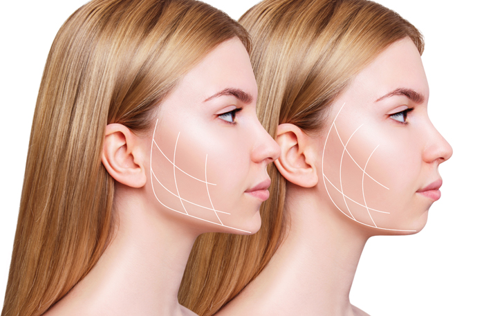 Young,Woman,With,Lifting,Lines,Before,And,After,Chin,Correction