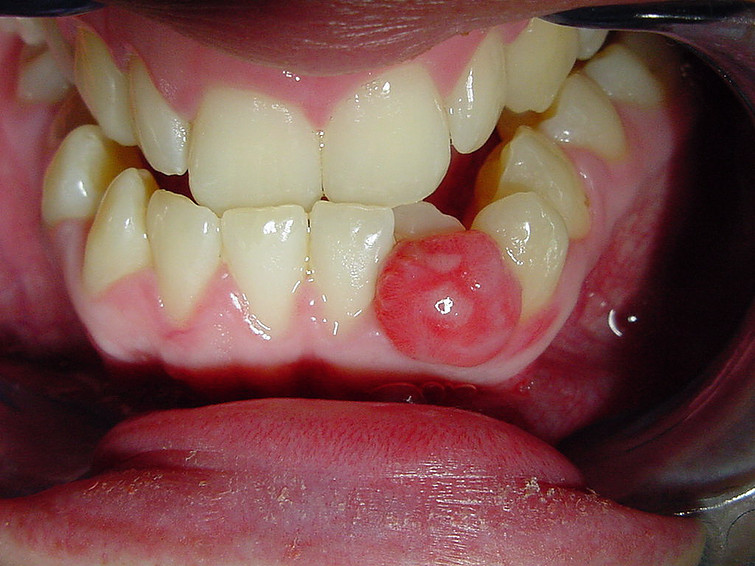 Oral-Pathology-and-Jaw-Cysts-1