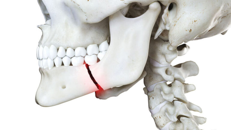 facial-trauma-brighton-oral-surgeon